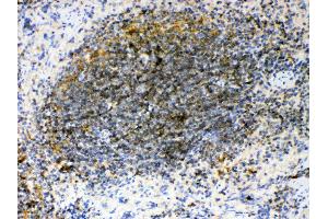 IHC analysis of GAS 6 using anti- GAS 6 antibody . (GAS6 antibody  (AA 488-660))