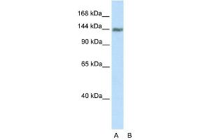 Western Blot showing TIMELESS antibody used at a concentration of 1-2 ug/ml to detect its target protein. (TIMELESS antibody  (C-Term))