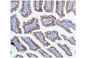 IHC analysis of Hexokinase 1/HK1 using anti-Hexokinase 1/HK1 antibody (ABIN7600259). (Hexokinase 1 antibody  (AA 17-323))