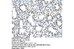 Rabbit Anti-PRMT5 Antibody  Paraffin Embedded Tissue: Human Lung Cellular Data: Alveolar cells Antibody Concentration: 4. (PRMT5 antibody  (N-Term))