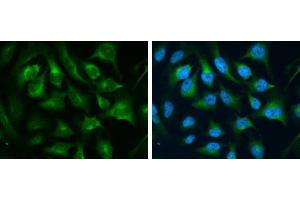 ICC/IF Image CD71 antibody [N2C1], Internal detects CD71 protein at cytoplasm by immunofluorescent analysis. (Transferrin Receptor antibody)