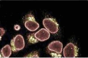 Immunofluorescence staining of HeLa cells (Human cervical epitheloid carcinoma, ATCC CCL-2).