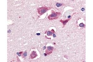 Image no. 1 for anti-Tumor Necrosis Factor (Ligand) Superfamily, Member 10 (TNFSF10) (C-Term) antibody (ABIN201278) (TRAIL antibody  (C-Term))