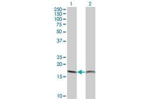 Western Blot analysis of PTH expression in transfected 293T cell line by PTH monoclonal antibody (M14), clone 3E7. (PTH antibody  (AA 32-115))