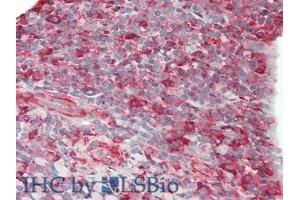 IHC-P analysis of Human Tonsil Tissue, with HE staining.