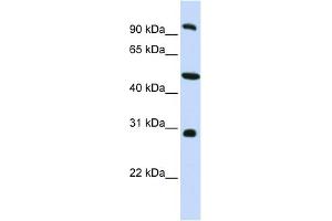 WB Suggested Anti-EML1 Antibody Titration: 0. (EML1 antibody  (C-Term))