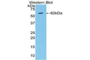 Western Blotting (WB) image for anti-Hypoxia Inducible Factor 1, alpha Subunit (Basic Helix-Loop-Helix Transcription Factor) (HIF1A) (AA 220-349) antibody (ABIN2934006)
