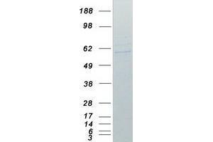 Western Blotting (WB) image for TNF Receptor-Associated Factor 2 (TRAF2) protein (Myc-DYKDDDDK Tag) (ABIN2734112)