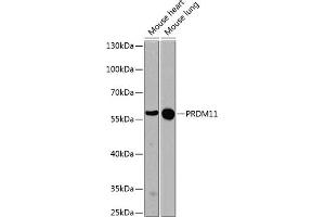 Western blot analysis of extracts of various cell lines, using PRDM11 antibody (ABIN6128494, ABIN6146129, ABIN6146131 and ABIN6224586) at 1:1000 dilution. (PRDM11 antibody  (AA 228-477))