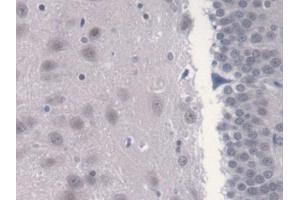 IHC-P analysis of Rat Cerebrum Tissue, with DAB staining. (CAMLG antibody  (AA 1-188))