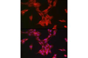 Immunofluorescence analysis of PC-12 cells using MRPL28 Rabbit mAb (ABIN7268566) at dilution of 1:100 (40x lens). (MRPL28 antibody)