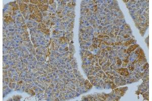 ABIN6277029 at 1/100 staining Human pancreas tissue by IHC-P. (CD70 antibody  (Internal Region))