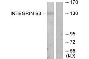 Western blot analysis of extracts from HepG2 cells, using Integrin beta3 (Ab-773) Antibody. (Integrin beta 3 antibody  (AA 731-780))