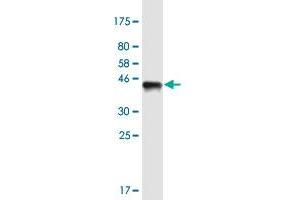 Western Blotting (WB) image for anti-WD Repeat and HMG-Box DNA Binding Protein 1 (WDHD1) (AA 1031-1128) antibody (ABIN1774840)
