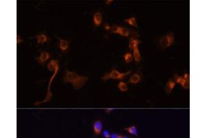Immunofluorescence analysis of A431 cells using ABL1 Polyclonal Antibody at dilution of 1:100 (40x lens). (ABL1 antibody)