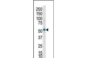 Western blot analysis of anti-SKG2 Pab in placenta lysate (SGK2 antibody  (C-Term))