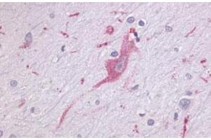 Immunohistochemical (Formalin/PFA-fixed paraffin-embedded sections) staining in human brain, neurons and glia with LPHN1 polyclonal antibody . (Latrophilin 1 antibody  (Extracellular Domain))