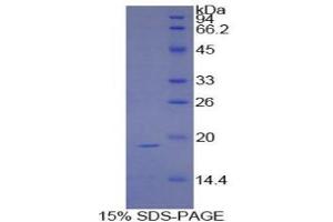 SDS-PAGE (SDS) image for Sucrase-Isomaltase (Alpha-Glucosidase) (SI) (AA 1717-1827) protein (His tag) (ABIN1080843)