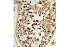 Immunohistochemistry analysis of human testis tissue (formalin-fixed, paraffin-embedded) using Chondroitin sulfate synthase 2  Antibody , which was peroxidase-conjugated to the secondary antibody, followed by DAB staining. (CHPF antibody  (Middle Region))
