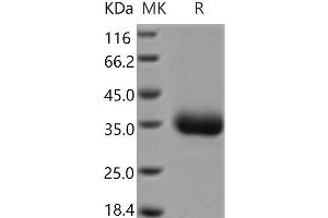 Western Blotting (WB) image for Layilin (LAYN) protein (His tag) (ABIN7321084) (Layilin Protein (LAYN) (His tag))