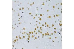 Immunohistochemistry of paraffin-embedded mouse brain using SNRNP70 antibody. (SNRNP70 antibody  (AA 150-250))