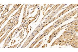 Immunohistochemistry (IHC) image for anti-Catalase (CAT) (AA 401-523) antibody (ABIN7434887)