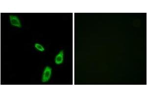 Immunofluorescence analysis of LOVO cells, using ADRA1B Antibody.