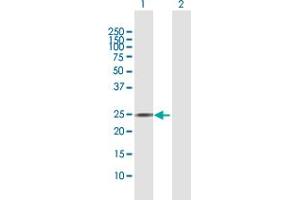 Western Blot analysis of AGPAT2 expression in transfected 293T cell line by AGPAT2 MaxPab polyclonal antibody. (AGPAT2 antibody  (AA 1-278))