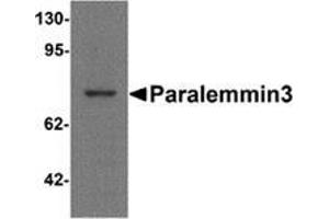 Western blot analysis of Paralemmin3 in MCF7 cell lysate with Paralemmin-3 Cat.