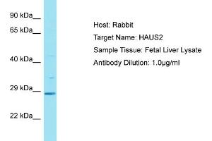 Host: Rabbit Target Name: HAUS2 Sample Tissue: Human Fetal Liver Antibody Dilution: 1ug/ml (HAUS2 antibody  (C-Term))