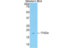 Western blot analysis of recombinant Rat IL1R1. (IL1R1 antibody  (AA 226-352))