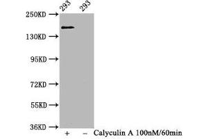 Western Blot Positive WB detected in 293 whole cell lysate(treated with Calyculin A or not) All lanes Phospho-SMC1A antibody at 1. (Recombinant SMC1A antibody  (pSer957))