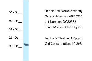 Western Blotting (WB) image for anti-MORN Repeat Containing 4 (MORN4) (C-Term) antibody (ABIN2785367) (MORN4 antibody  (C-Term))