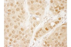Immunohistochemistry (IHC) image for anti-V-Akt Murine Thymoma Viral Oncogene Homolog 1 (AKT1) (AA 25-75) antibody (ABIN7448406) (AKT1 antibody  (AA 25-75))