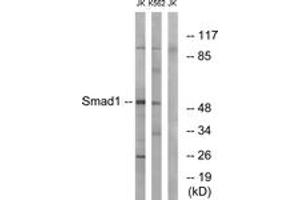 Western blot analysis of extracts from Jurkat/K562 cells, using Smad1 (Ab-187) Antibody. (SMAD1 antibody  (AA 153-202))
