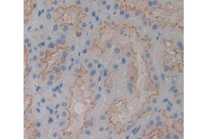 Used in DAB staining on fromalin fixed paraffin- embedded kidney tissue (PTPMT1 antibody  (AA 71-197))