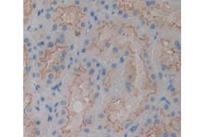 Used in DAB staining on fromalin fixed paraffin- embedded kidney tissue (PTPMT1 antibody  (AA 71-197))