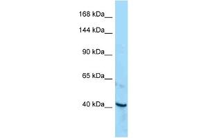 Western Blotting (WB) image for anti-Receptor Tyrosine Kinase-Like Orphan Receptor 1 (ROR1) (C-Term) antibody (ABIN2789668) (ROR1 antibody  (C-Term))