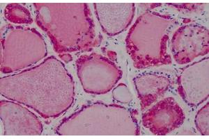 Human Thyroid: Formalin-Fixed, Paraffin-Embedded (FFPE) (Peroxiredoxin 1 antibody  (AA 1-184))