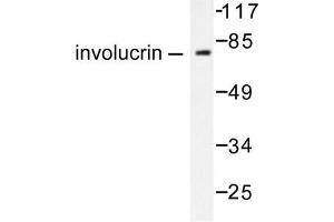 Image no. 1 for anti-Involucrin (IVL) antibody (ABIN265482) (Involucrin antibody)