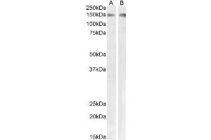 PLA2R1 antibody  (Internal Region)