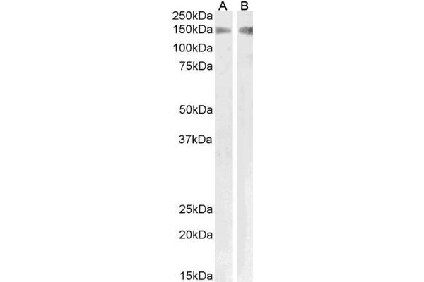 PLA2R1 antibody  (Internal Region)