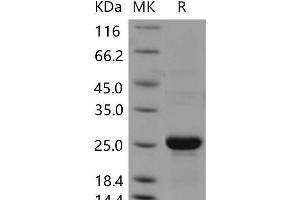 CLEC3B Protein (His tag)