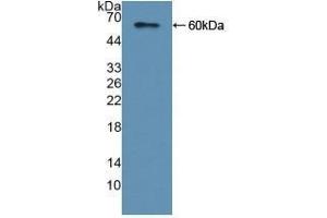 Detection of Recombinant CAP2, Human using Polyclonal Antibody to Adenylyl Cyclase Associated Protein 2 (CAP2) (CAP2 antibody  (AA 1-477))