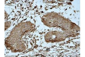 IHC analysis of formalin-fixed paraffin-embedded fetal testis showing cytoplasmic staining, using MEI1 antibody (1/100 dilution). (MEI1 antibody  (AA 44-237))
