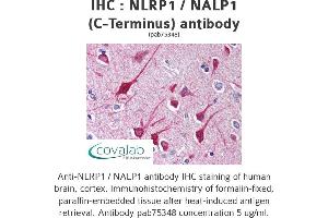 Image no. 1 for anti-NLR Family, Pyrin Domain Containing 1 (NLRP1) antibody (ABIN1737385) (NLRP1 antibody)