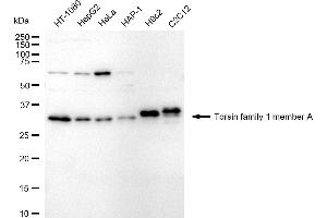 Western blotting analysis using torsin family 1 member A antibody (ABIN7800575).