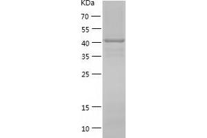 Western Blotting (WB) image for Cytohesin 3 (CYTH3) (AA 1-399) protein (His tag) (ABIN7122588)