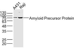 Lane 1: A431 lysates Lane 2: Raji lysates Jurkat lysates probed with Amyloid Precursor Protein Antibody, Unconjugated  at 1:300 dilution and 4˚C overnight incubation. (APP antibody  (AA 381-480))