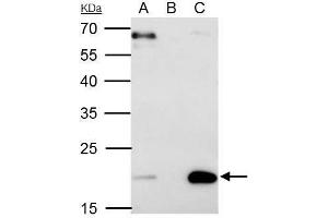 IP Image Sorcin antibody [N1C3] immunoprecipitates Sorcin protein in IP experiments. (SRI antibody)